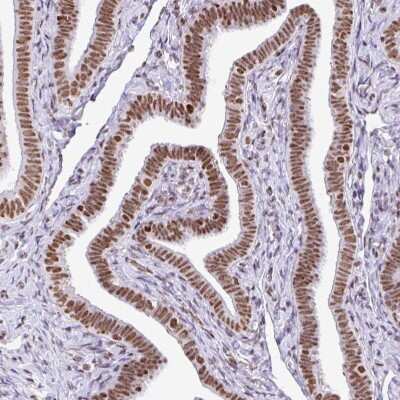 Immunohistochemistry-Paraffin: RAR gamma/NR1B3 Antibody [NBP2-47314] - Staining of human Fallopian tube shows strong nuclear positivity in glandular cells.