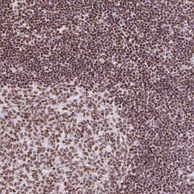Immunohistochemistry-Paraffin: RAR gamma/NR1B3 Antibody [NBP2-47314] - Staining of human Lymph node shows strong nuclear positivity in germinal and non-germinal center cells.