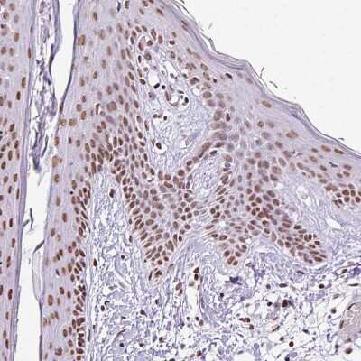 Immunohistochemistry-Paraffin: RAR gamma/NR1B3 Antibody [NBP2-47314] - Staining of human Skin shows strong nuclear positivity in squamous epithelial cells.