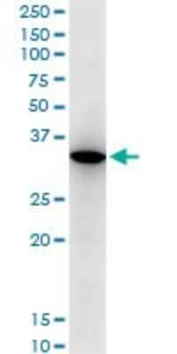 Western Blot: RARRES1 Antibody (2E2) [H00005918-M06] - Analysis of RARRES1 expression in HL-60(Cat # L014V1).