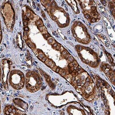 Immunohistochemistry-Paraffin: RARRES1 Antibody (513509) [Unconjugated] [MAB4255] - RARRES1 was detected in immersion fixed paraffin-embedded sections of human kidney tissue using RARRES1 Monoclonal Antibody (clone 513509) at 5 ug/ml. Basic antigen retrieval was done using catalog number CTS013. Tissue was stained using the Chromogenic anti-mouse HRP-DAB (catalog number VCTS001) and counterstained with hematoxylin (blue). 