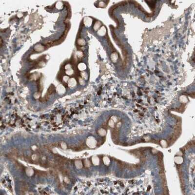 Immunohistochemistry-Paraffin: RARRES1 Antibody [NBP1-80684] - Staining of human duodenum shows strong cytoplasmic positivity in glandular cells.