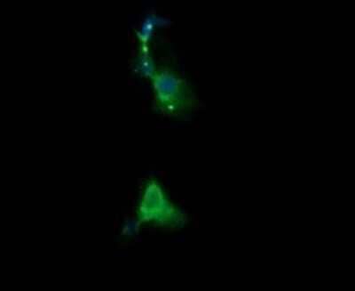 Immunocytochemistry/Immunofluorescence: RARRES1 Antibody (OTI1D2) - Azide and BSA Free [NBP2-73803] - Analysis of COS7 cells transiently transfected by pCMV6-ENTRY RARRES1.