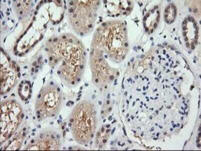 Immunohistochemistry: RARRES1 Antibody (OTI1D2) - Azide and BSA Free [NBP2-73803] - Analysis of Human Kidney tissue. (Heat-induced epitope retrieval by 10mM citric buffer, pH6.0, 120C for 3min)