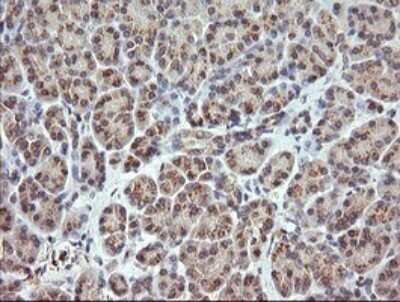 Immunohistochemistry: RARRES1 Antibody (OTI1D2) - Azide and BSA Free [NBP2-73803] - Analysis of Human pancreas tissue. (Heat-induced epitope retrieval by 10mM citric buffer, pH6.0, 120C for 3min)