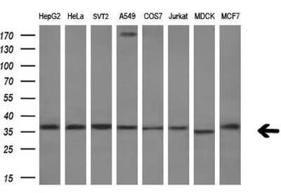 Western Blot: RARRES1 Antibody (OTI1D2) - Azide and BSA Free [NBP2-73803] - Analysis of extracts (10ug) from 8 different cell lines by using RARRES1 monoclonal antibody.