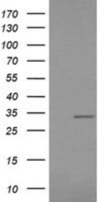 Western Blot RARRES1 Antibody (OTI1D2) - Azide and BSA Free