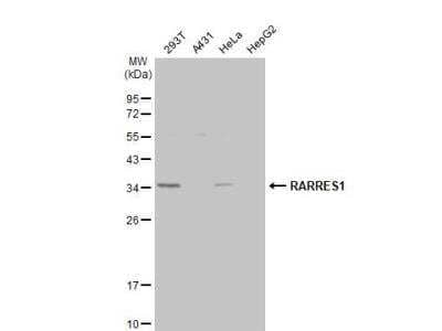 Western Blot: RARRES1 Antibody [NBP2-20079] - Various whole cell extracts (30 ug) were separated by 12% SDS-PAGE, and the membrane was blotted with RARRES1 antibody [N2C3]  diluted at 1:2000. The HRP-conjugated anti-rabbit IgG antibody (NBP2-19301) was used to detect the primary antibody, and the signal was developed with Trident ECL plus-Enhanced.