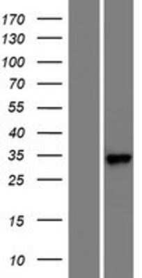 Western Blot RARRES1 Overexpression Lysate