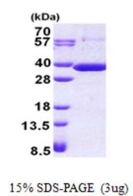 SDS-PAGE Recombinant Human RARRES1 His Protein