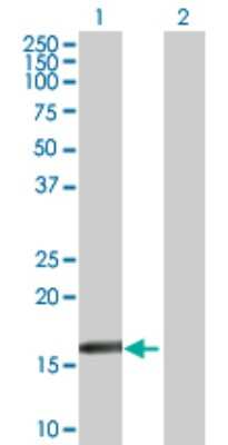 Western Blot: RARRES3 Antibody [H00005920-B02P] - Analysis of RARRES3 expression in transfected 293T cell line by RARRES3 polyclonal antibody.  Lane 1: RARRES3 transfected lysate(18.04 KDa). Lane 2: Non-transfected lysate.