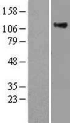 Western Blot: RAS p21 Overexpression Lysate (Adult Normal) [NBL1-15164] Left-Empty vector transfected control cell lysate (HEK293 cell lysate); Right -Over-expression Lysate for RAS p21.