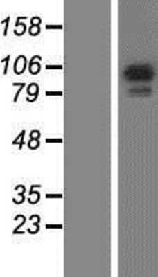 Western Blot: RASA3 Overexpression Lysate (Adult Normal) [NBP2-07501] Left-Empty vector transfected control cell lysate (HEK293 cell lysate); Right -Over-expression Lysate for RASA3.