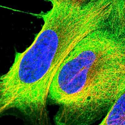 Immunocytochemistry/ Immunofluorescence RASAL1 Antibody - BSA Free