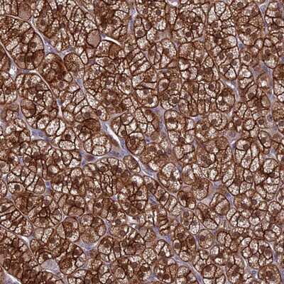 Immunohistochemistry-Paraffin: RASAL1 Antibody [NBP2-13204] - Staining of human adrenal gland shows strong membranous with additional cytoplasmic and nuclear positivity in glandular cells.