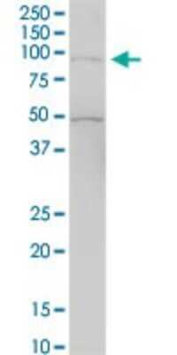 Western Blot: RASAL1 Antibody [H00008437-B01P] - Analysis of RASAL1 expression in rat brain.