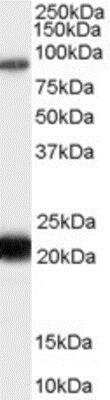 Western Blot RASAL1 Antibody