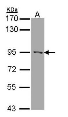 Western Blot: RASAL1 Antibody [NBP1-32776] - Sample (30 ug of whole cell lysate) A: A431 7.5% SDS PAGE, antibody diluted at 1:1000.