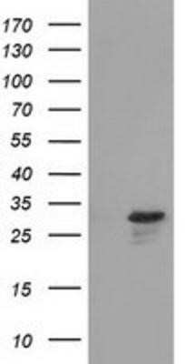 Western Blot: RASD2 Antibody (OTI1F7) - Azide and BSA Free [NBP2-73808] - HEK293T cells were transfected with the pCMV6-ENTRY control (Left lane) or pCMV6-ENTRY RASD2 (Right lane) cDNA for 48 hrs and lysed. Equivalent amounts of cell lysates (5 ug per lane) were separated by SDS-PAGE and immunoblotted with anti-RASD2.