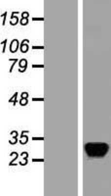 Western Blot: RASD2 Overexpression Lysate (Adult Normal) [NBL1-15169] Left-Empty vector transfected control cell lysate (HEK293 cell lysate); Right -Over-expression Lysate for RASD2.