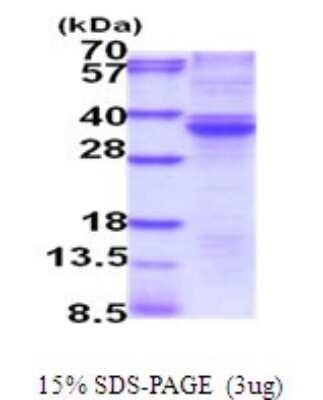 SDS-PAGE Recombinant Human RASD2 His Protein