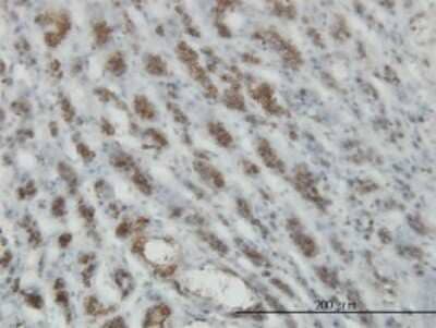 Immunohistochemistry-Paraffin: RASEF Antibody (2D5) [H00158158-M01] - Analysis of monoclonal antibody to RASEF on formalin-fixed paraffin-embedded human adrenal gland. Antibody concentration 3 ug/ml.