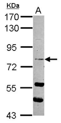 Western Blot: RASEF Antibody [NBP2-20083] - Sample (30 ug of whole cell lysate) A: A431 7. 5% SDS PAGE gel, diluted at 1:1000.
