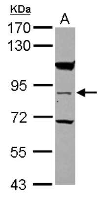 Western Blot: RASEF Antibody [NBP2-20084] - Sample (30 ug of whole cell lysate) A: A431 7. 5% SDS PAGE gel, diluted at 1:1000.