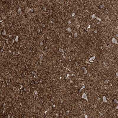 Immunohistochemistry-Paraffin RASGEF1A Antibody - BSA Free