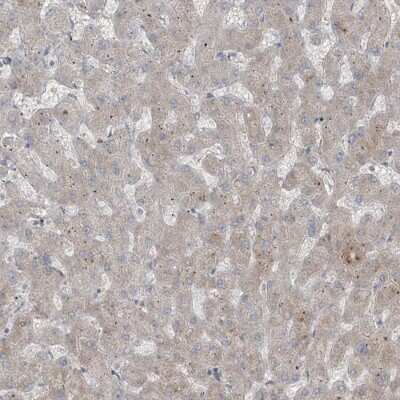 Immunohistochemistry-Paraffin RASGEF1A Antibody - BSA Free