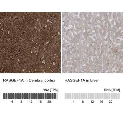 Immunohistochemistry-Paraffin RASGEF1A Antibody - BSA Free