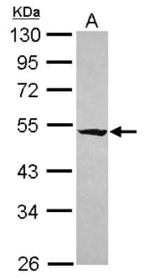 Western Blot: RASGEF1A Antibody [NBP2-20085] - Sample (30 ug of whole cell lysate) A: IMR32 10% SDS PAGE gel, diluted at 1:5000.