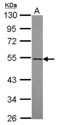 Western Blot: RASGEF1A Antibody [NBP2-20086] - Sample (30 ug of whole cell lysate) A: A431 10% SDS PAGE gel, diluted at 1:1000.