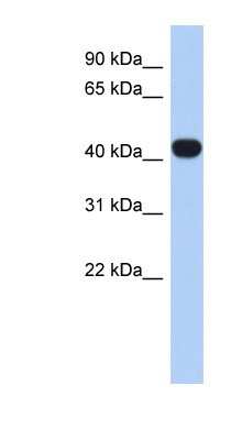 Western Blot: RASGEF1C Antibody [NBP1-58878] - Human Heart lysate, concentration 0.2-1 ug/ml.