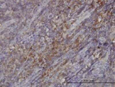 Immunohistochemistry-Paraffin: RASGRP 4 Antibody (1F3) [H00115727-M01] - Analysis of monoclonal antibody to RASGRP4 on formalin-fixed paraffin-embedded human tonsil. Antibody concentration 3 ug/ml.
