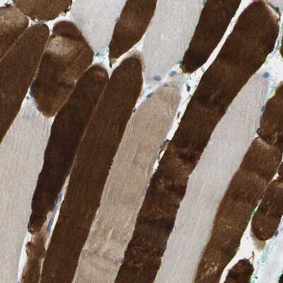 Immunohistochemistry-Paraffin RASGRP2 Antibody - BSA Free