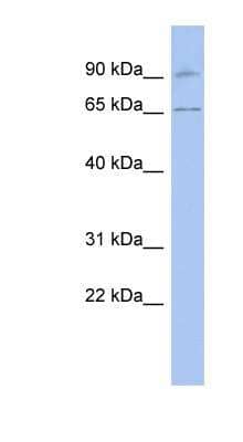 Western Blot: RASGRP2 Antibody [NBP1-58871] - Titration: 0.2-1 ug/ml, Positive Control: Human brain.