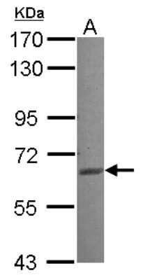 Western Blot: RASGRP2 Antibody [NBP2-20089] - Sample (30 ug of whole cell lysate) A: NT2D1 7. 5% SDS PAGE gel, diluted at 1:1000.