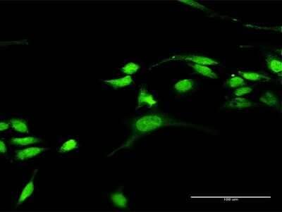 Immunocytochemistry/Immunofluorescence: RASGRP3 Antibody [H00025780-D01P] - Analysis of antibody to RASGRP3 on HeLa cell. Antibody concentration 30 ug/ml.