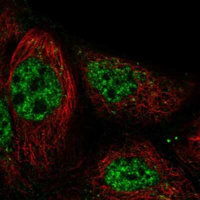 Immunocytochemistry/Immunofluorescence: RASGRP3 Antibody [NBP2-58546] - Staining of human cell line CACO-2 shows localization to nucleoplasm & the Golgi apparatus.