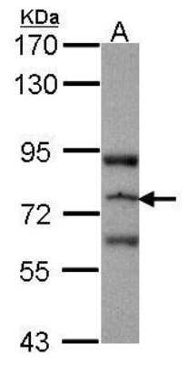 Western Blot: RASGRP3 Antibody [NBP1-31501] - Analysis of NBP1-31501 on JurKat, with 7.5% SDS PAGE, diluted at 1:1000.