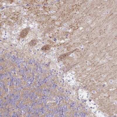 Immunohistochemistry-Paraffin: RASL10A Antibody [NBP2-34210] - Staining of human cerebellum shows moderate cytoplasmic positivity in Purkinje cells.