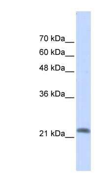 Western Blot: RASL10A Antibody [NBP1-58920] - Transfected 293T cell lysate, concentration 0.2-1 ug/ml.