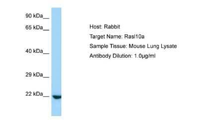 Western Blot: RASL10A Antibody [NBP1-98422] - Antibody Dilution: 1.0ug/ml Sample Tissue: Mouse Lung.