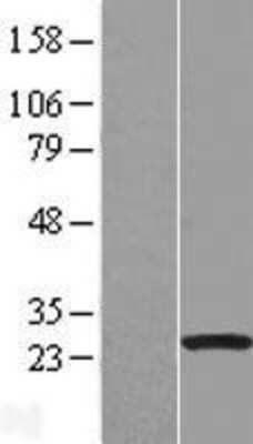 Western Blot: RASL10A Overexpression Lysate (Adult Normal) [NBL1-15172] Left-Empty vector transfected control cell lysate (HEK293 cell lysate); Right -Over-expression Lysate for RASL10A.