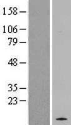 Western Blot: RASL10A Overexpression Lysate (Adult Normal) [NBL1-15173] Left-Empty vector transfected control cell lysate (HEK293 cell lysate); Right -Over-expression Lysate for RASL10A.