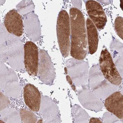 Immunohistochemistry-Paraffin: RASL10B Antibody [NBP2-38817] - Staining of human skeletal muscle shows strong cytoplasmic positivity in myocytes.