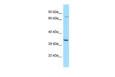 Western Blot: RASL11A Antibody [NBP2-85606] - WB Suggested Anti-RASL11A Antibody. Titration: 1.0 ug/ml. Positive Control: MCF7 Whole Cell