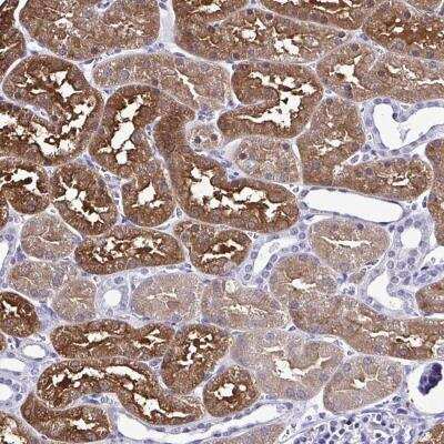 Immunohistochemistry-Paraffin RASL11B Antibody