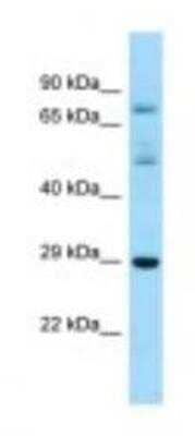 Western Blot RASL12 Antibody - BSA Free